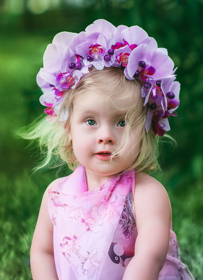 20 Pictures Of A Cute Down Syndrome Child Taken By Her Adoptive Mom